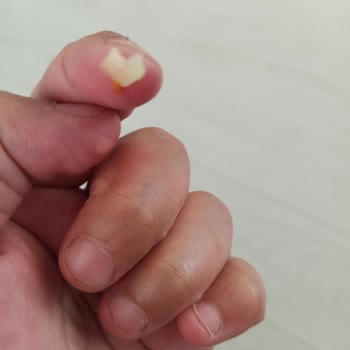 Knorr Çabuk Çorbadan Kıl Ve Cisim Çıkması