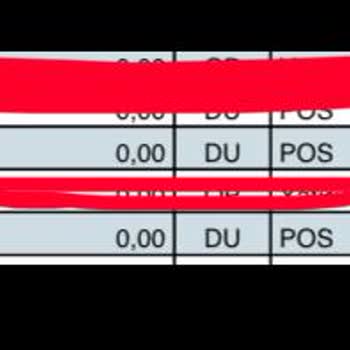 Magro Fazla Para Çekimi