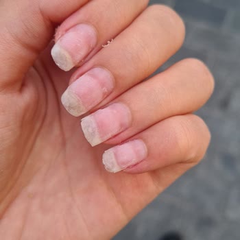 Gratis Beauty Kalıcı Oje Ve Protez Çıkartma İşlemi