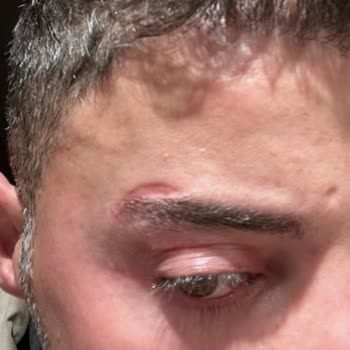 Alanya Estegöz Klinik Alanya Mağduriyet Yaşama