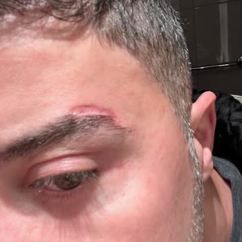 Alanya Estegöz Klinik Alanya Mağduriyet Yaşama