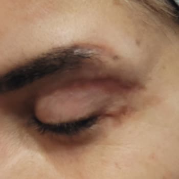 Eki aç