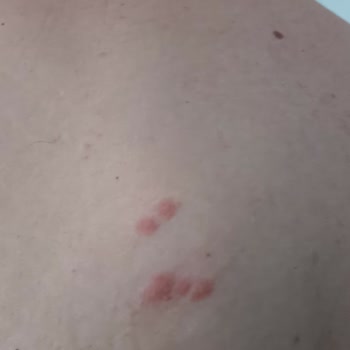 Keşan Belediyesi Keşan Erikli Kiralık Ev