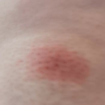 Keşan Belediyesi Keşan Erikli Kiralık Ev