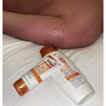 Sebamed SPF 50 Sunscreen Protection Is So Low It Caused Sun Burns