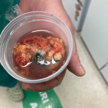 Özel Okmeydanı Hastanesi Yanlış Doktor Tercihi
