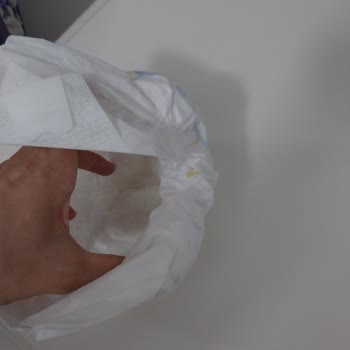 Molfix Bez Mağduriyeti Bezler Eskisi Gibi Değil