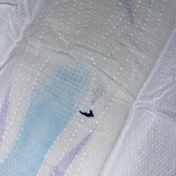 Molped Gece Pedinin İçinden Koyu Renkli Ve Sert Bir Cisim Çıktı