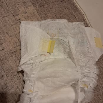 Prima Premium Care 5 Yan Bantlar Kopuyor Sürekli