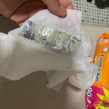 Fresh'n Soft Bebek Islak Mendili İçinden Yabancı Cisim Çıkması