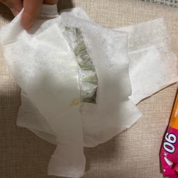 Fresh'n Soft Bebek Islak Mendili İçinden Yabancı Cisim Çıkması