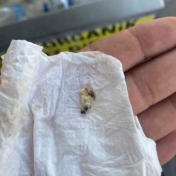 Linaria Pastaneleri Hijyensiz Bir Ortam ( Sahanda Yumurtanın İçinden Sinek Çıktı)