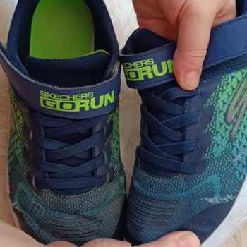 Skechers Ürünlerinin Kalitesizliği Ve Ürününün Arkasında Durmaması