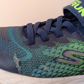 Skechers Ürünlerinin Kalitesizliği Ve Ürününün Arkasında Durmaması
