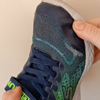 Skechers Ürünlerinin Kalitesizliği Ve Ürününün Arkasında Durmaması