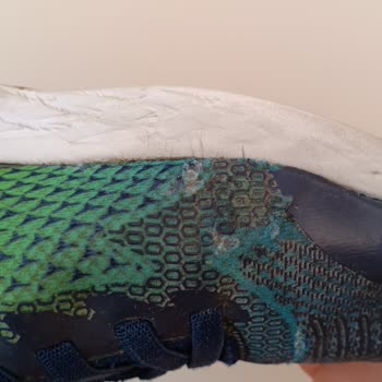Skechers Ürünlerinin Kalitesizliği Ve Ürününün Arkasında Durmaması