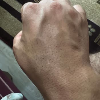 Deepclean Ürün Tüy Ve Kıl Almıyor!
