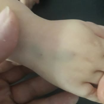 Samsun Medicana Damar Yolu Açamama Beceriksizliği