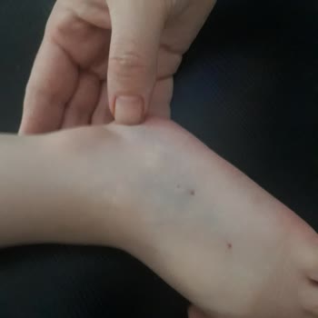 Samsun Medicana Damar Yolu Açamama Beceriksizliği