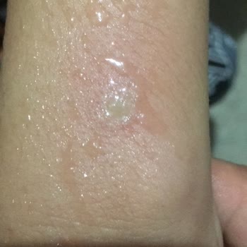 Turkcell Kolda Yanma Yaptı