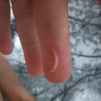 Atatürk Orman Çiftliği Dondurmamdan Tırnak Çıktı
