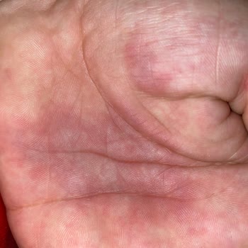 Marmara Üniversitesi Pendik Eğitim Ve Araştırma Hastanesi Hayat İle Oynuyor!