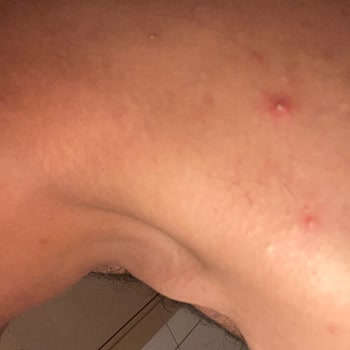 Marmara Üniversitesi Pendik Eğitim Ve Araştırma Hastanesi Hayat İle Oynuyor!