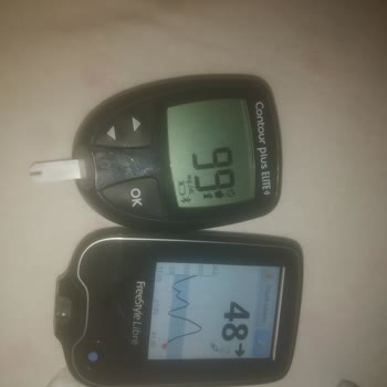 Freestyle Libre Sensör Ölçüm Hatası