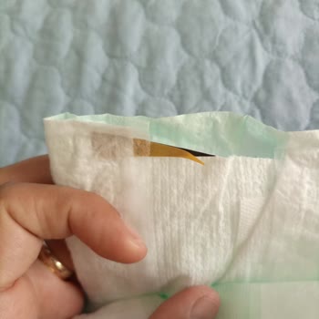 Molfix Bezin Kenarında Yabancı Cisim