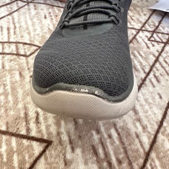 Skechers Ayakkabısının Deri Dökülmesi Ve Soyulması