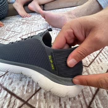 Skechers Ayakkabısının Deri Dökülmesi Ve Soyulması
