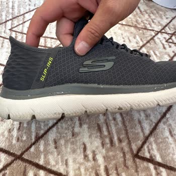 Skechers Ayakkabısının Deri Dökülmesi Ve Soyulması