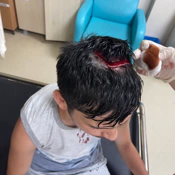 Kocaali Belediyesi Fatih Sultan Mehmet Caddesinde ki Park Oğlumu Hastanelik Etti