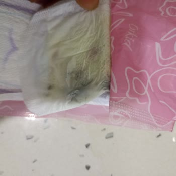 Orkid Kullanılmış Ped Çıktı