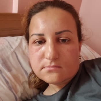 Zarais Düzce Luxe Aşının Yan Etkileri