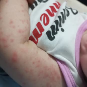 Bioderma ABC Şampuan Alerji