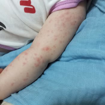 Bioderma ABC Şampuan Alerji