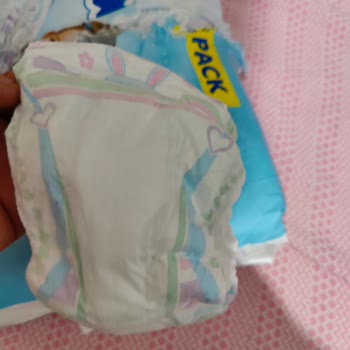 Molfix Bebek Bezi Sari Cizgi Bulunmaması