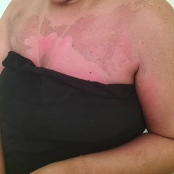 Selin Beauty Bronze Tan Güneş Yağı!