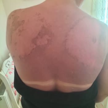 Selin Beauty Bronze Tan Güneş Yağı!