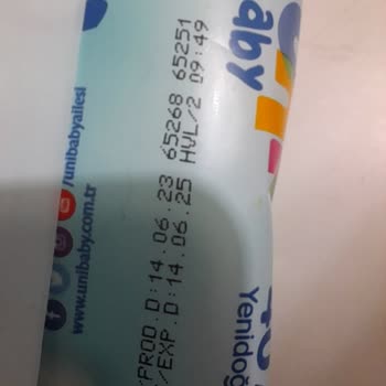 Uni Baby Islak Mendil Yüz Yakıyor!