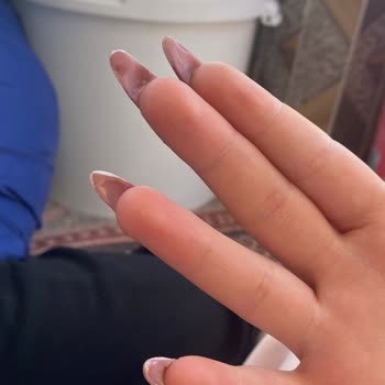 Aris Güzellik Merkezleri Protez Tırnak Mağduriyeti