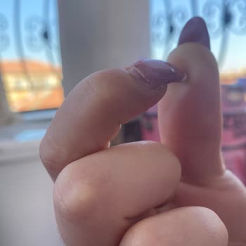 Aris Güzellik Merkezleri Protez Tırnak Mağduriyeti