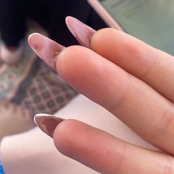 Aris Güzellik Merkezleri Protez Tırnak Mağduriyeti