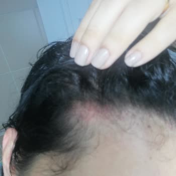 Elidor Turuncu Şampuan Kızarıklık Yanma