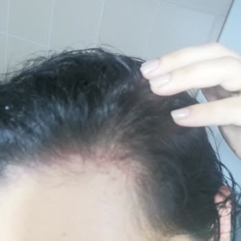 Elidor Turuncu Şampuan Kızarıklık Yanma