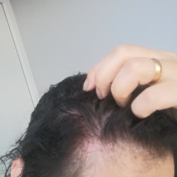 Elidor Turuncu Şampuan Kızarıklık Yanma