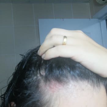 Elidor Turuncu Şampuan Kızarıklık Yanma