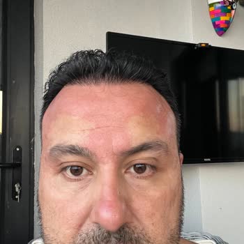 Sebamed Şampuan Vücutta Yanma Yapıyor