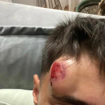 Yertaş Havai Fişek Yertaş Venüs Torch Meşale Patlaması